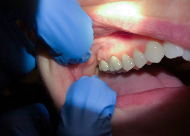 Best Emergency Orthodontic Repairs in Russellton, PA