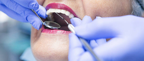 Best Emergency Tooth Extraction in Russellton, PA
