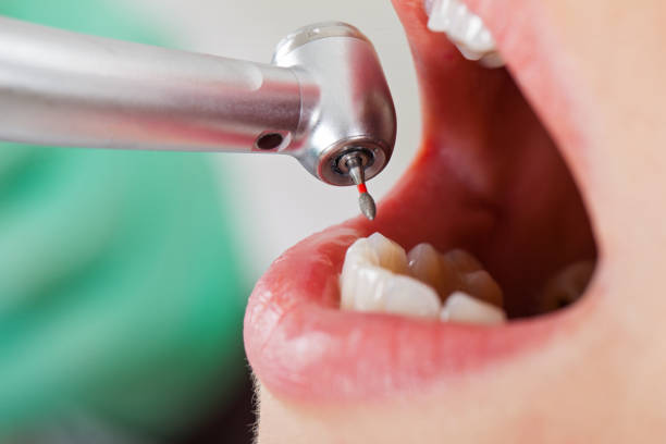 Best Emergency Treatment for Toothache in Russellton, PA